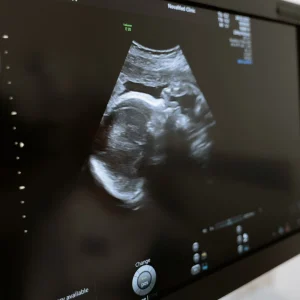 Ultrasonido Obstétrico