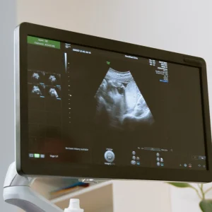 Ultrasonido de Próstata (con medición de orina residual)